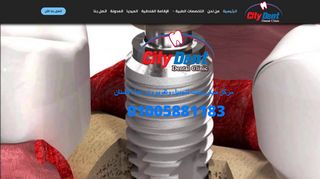 مركز سيتى دينت لتجميل وتقويم وزراعة الأسنان